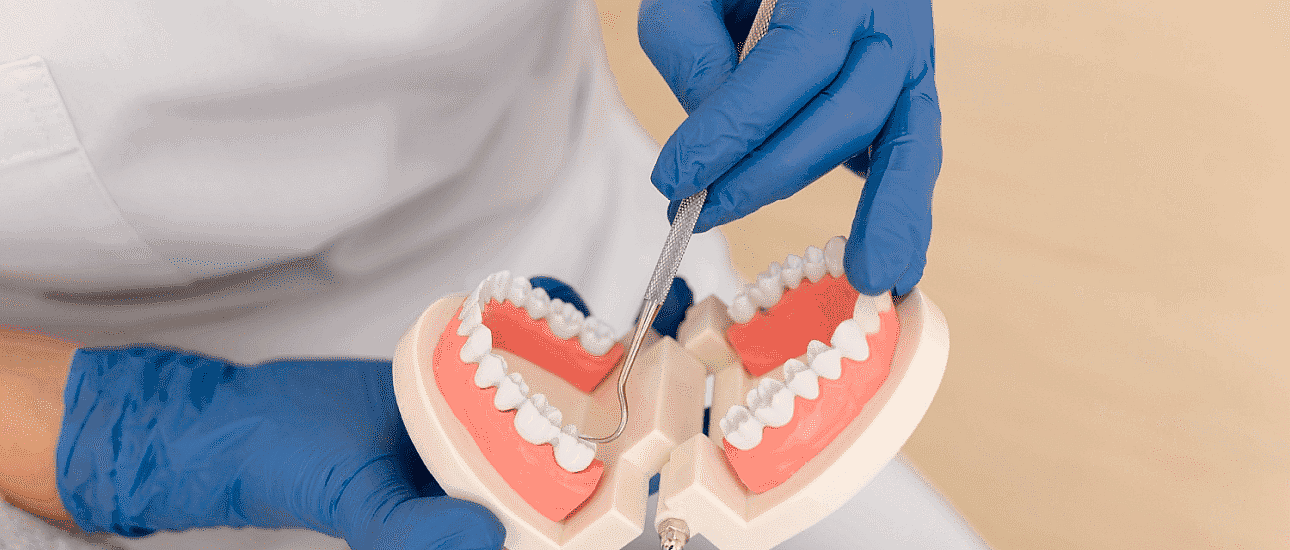 At Happy Smiles Orthodontics in St. Augustine, FL, a gloved professional uses dental tools to examine a plastic model highlighting an overbite.