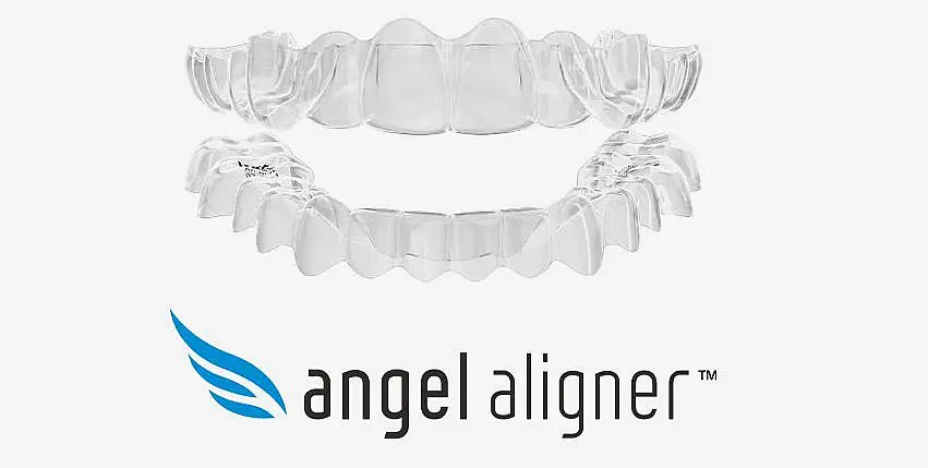 Angel Aligners: Save with Generic Aligners at Happy Smiles Orthodontics in St. Augustine, FL.