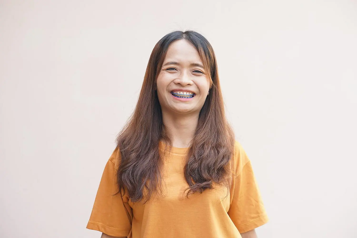 A woman with long brown hair and an orange t-shirt smiles brightly, showing her metal braces—one of the many options available at Happy Smiles Orthodontics in St. Augustine, FL.