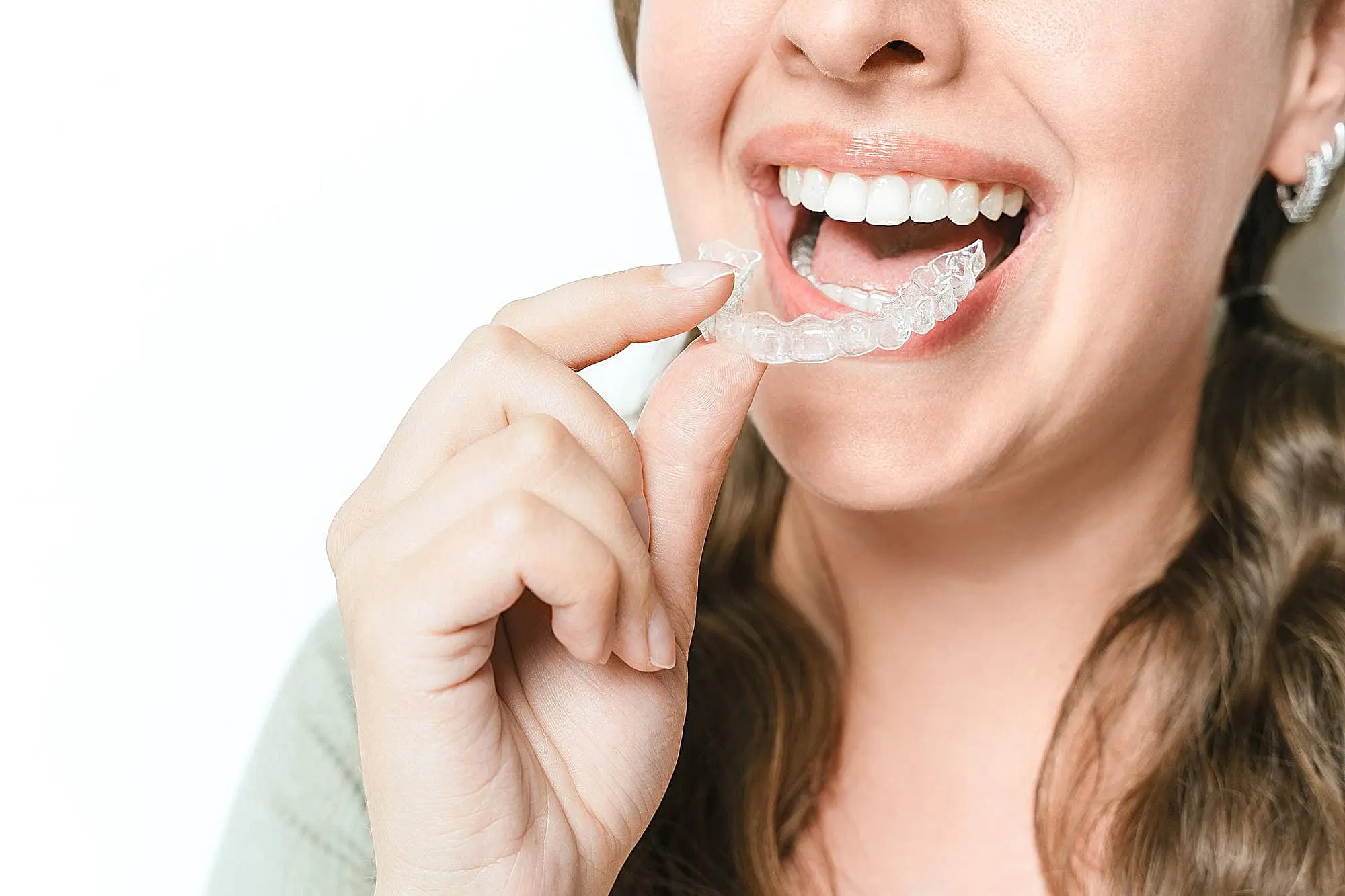 At Happy Smiles Orthodontics in St. Augustine, FL, a person smiles as they prepare to insert a clear dental aligner, weighing their options between Invisalign and braces.