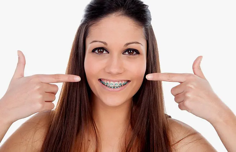 A young woman with long brown hair smiles and points to her braces, highlighting the benefits of adult orthodontics at Happy Smiles Orthodontics in St. Augustine, FL.