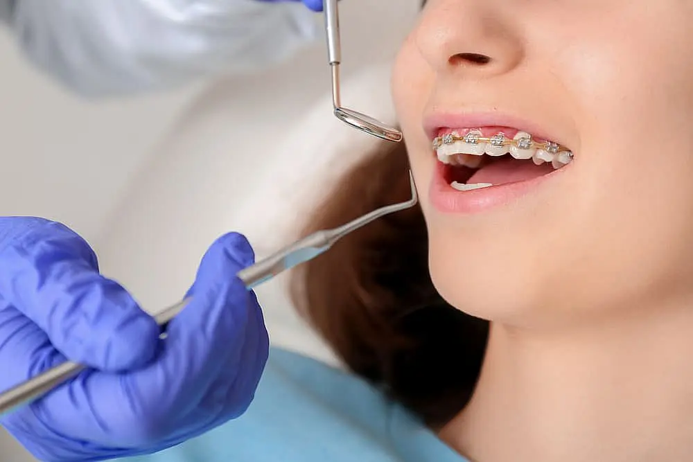 At Happy Smiles Orthodontics in St. Augustine, FL, a dental professional wearing blue gloves examines a patient’s teeth with metal braces using dental tools.