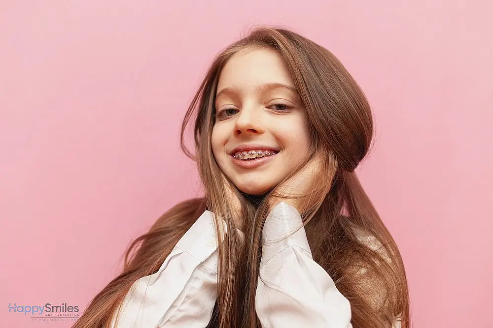A young girl with long brown hair and braces for overbite in St. Augustine, FL beams against a pink background, holding her face in both hands—showcasing her progress at Happy Smiles Orthodontics.