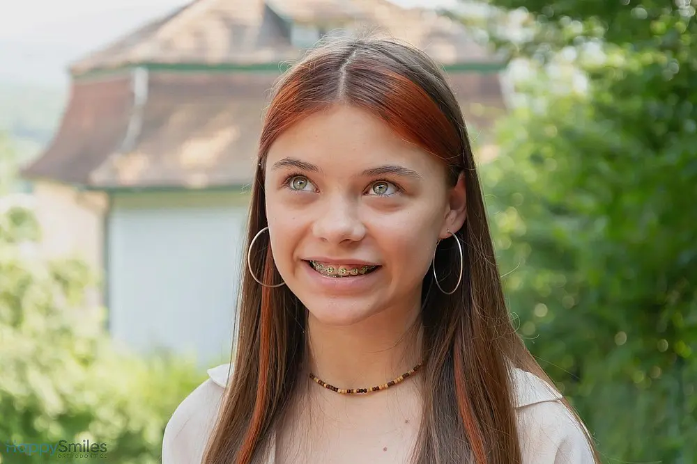 beautiful teenage girl metal braces smiles street - Clear Braces vs Metal Braces in St. Augustine, FL 