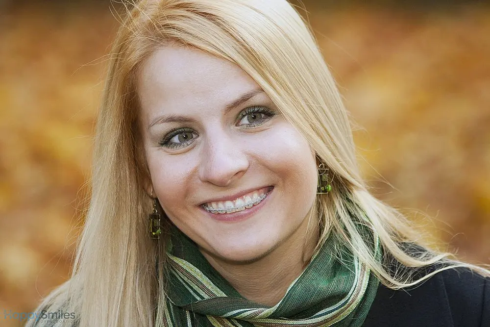 smiling blond young woman with clear braces - Clear Braces vs Metal Braces in St. Augustine, FL 
